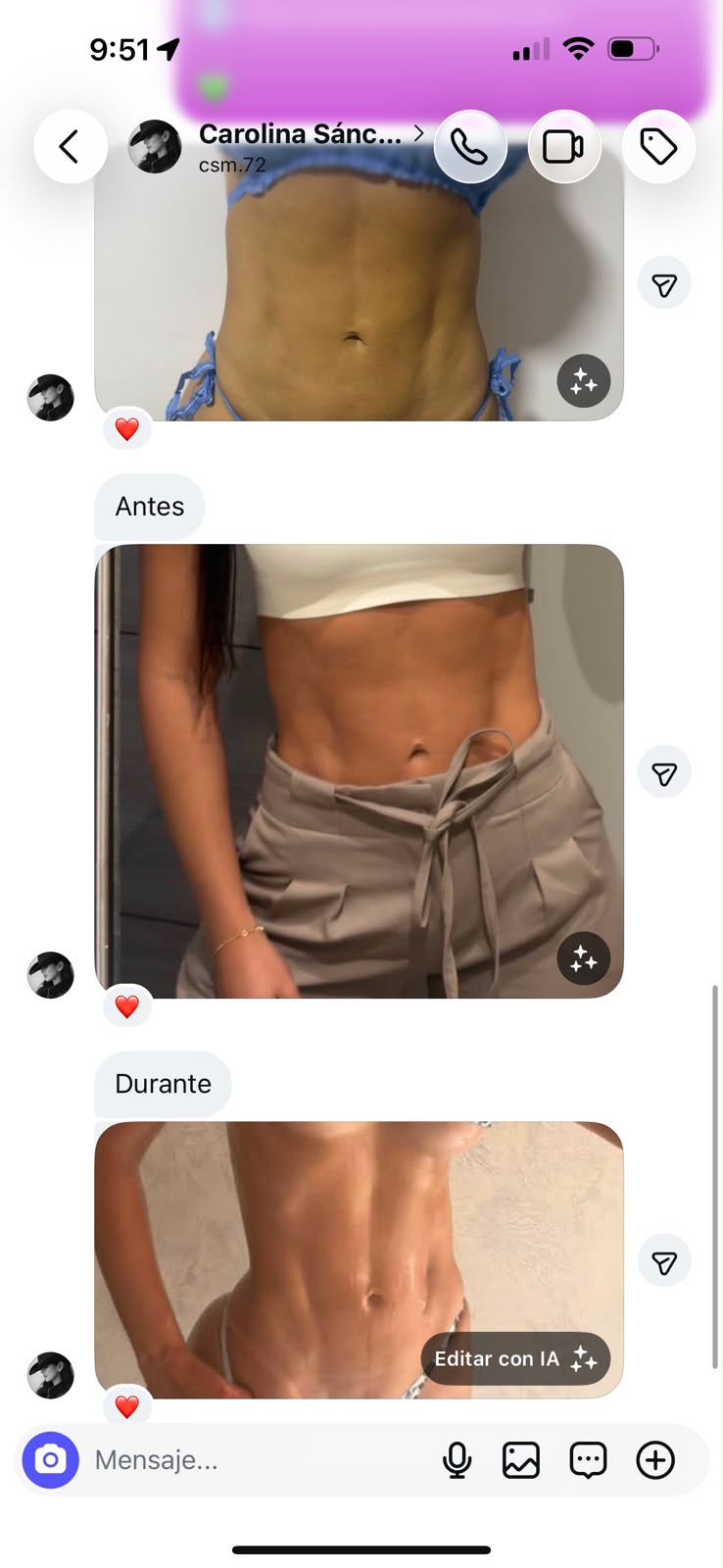Antes y durante de una clienta Sixteen